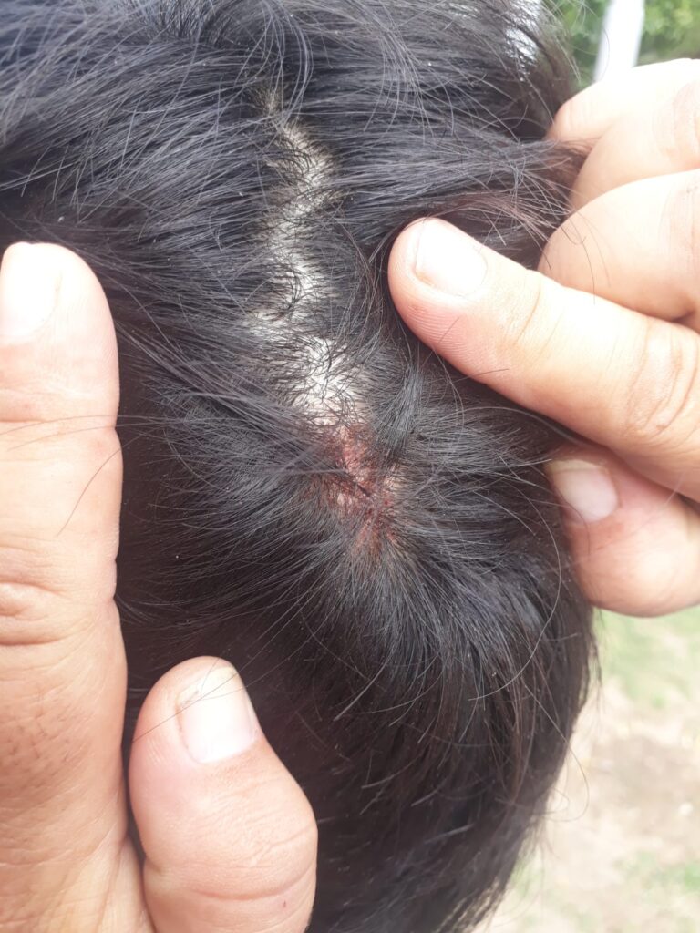 pelea san lorenzo y alumni