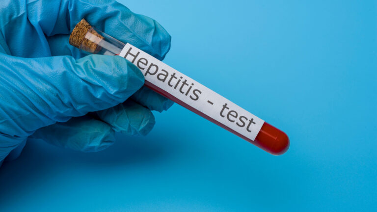Hepatitis-31
